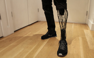 メッシュ構造の3Dプリンターの義足Exo Prosthetic Leg