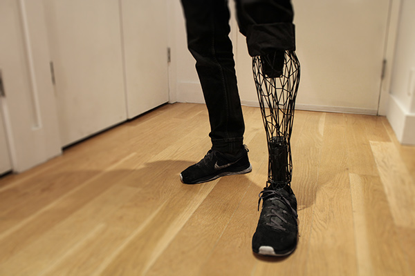 メッシュ構造の3Dプリンターの義足Exo Prosthetic Leg
