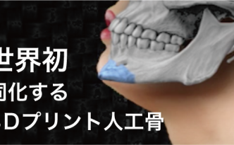 3Dプリント人工骨