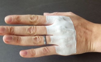テンプル大学が開発した3Dプリントの包帯